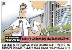 TRUMP'S ABORTION COMMENT,  by Randy Bish