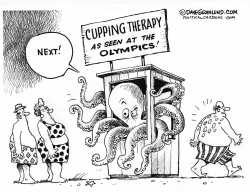 CUPPING THERAPY  by Dave Granlund